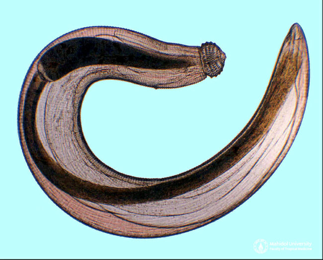 พยาธิตัวจี๊ด