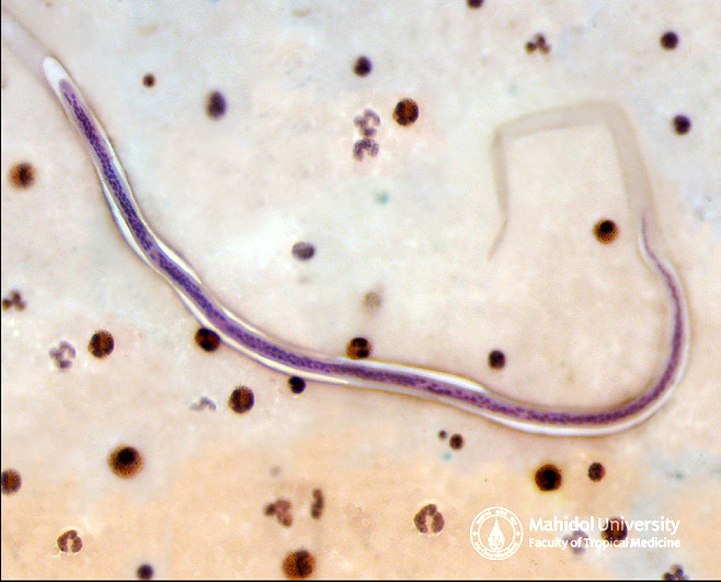 ?????????????????????????? ??????????????????????????