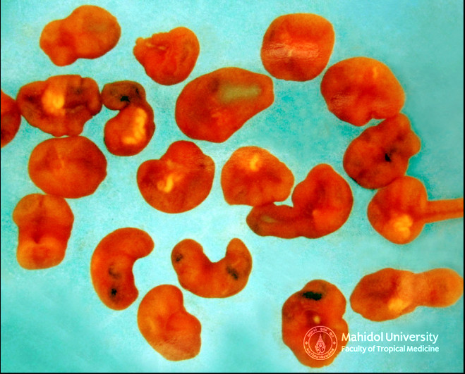 ????????????? ?????????????