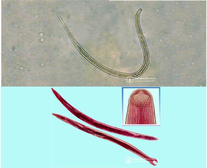 เส้นด้าย - ปากขอ เส้นด้าย - ปากขอ