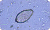 ไข่พยาธิใบไม้ตับ ไข่พยาธิใบไม้ตับ